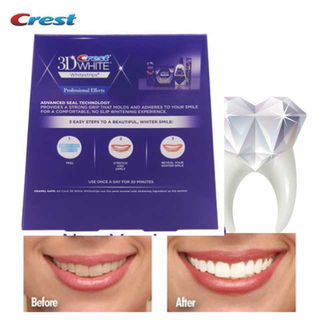 正規品] Crest 3D White Whitening Strips クレスト ホワイトニング テープ ホワイトニングストリップ 白い歯 自宅  ホーム デンタルケアー ヤニ取り【10セット/20枚】国内発送の通販はau PAY マーケット - Arlington | au PAY  マーケット－通販サイト